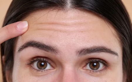 Ein vollständiger Leitfaden zur natürlichen und effektiven Behandlung von Stirnfalten