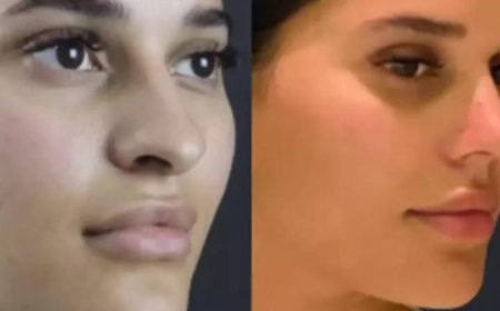Nose Surgery in Dubai for Breathing and Aesthetic Enhancement